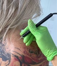 Behandlung zur Entfernung von Hautanomalien.